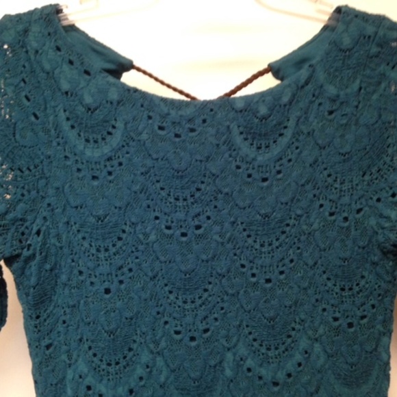 NIGHTCAP Lace Priscilla Open Back Dress EUC - Picture 7 of 12